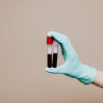 PCR-Test kostenlos in NRW