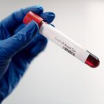 PCR Test Gültigkeit in NRW